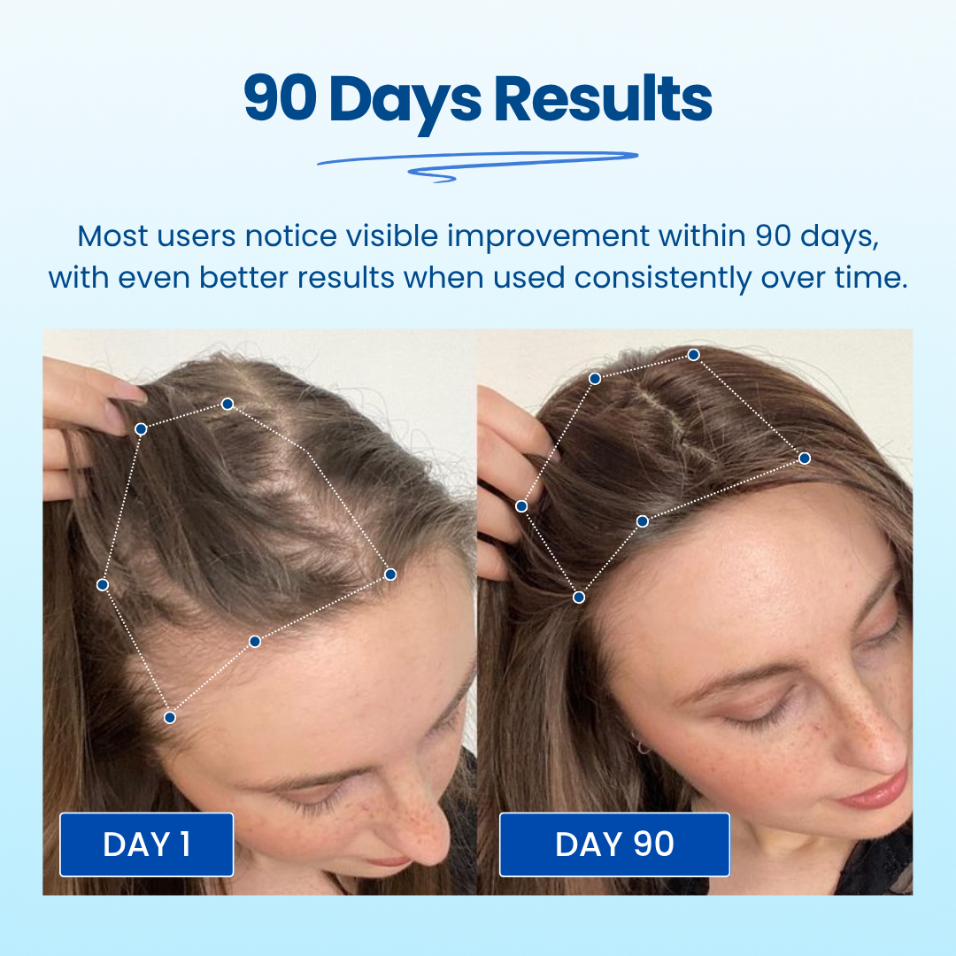 Advanced Hair Growth Roller Serum