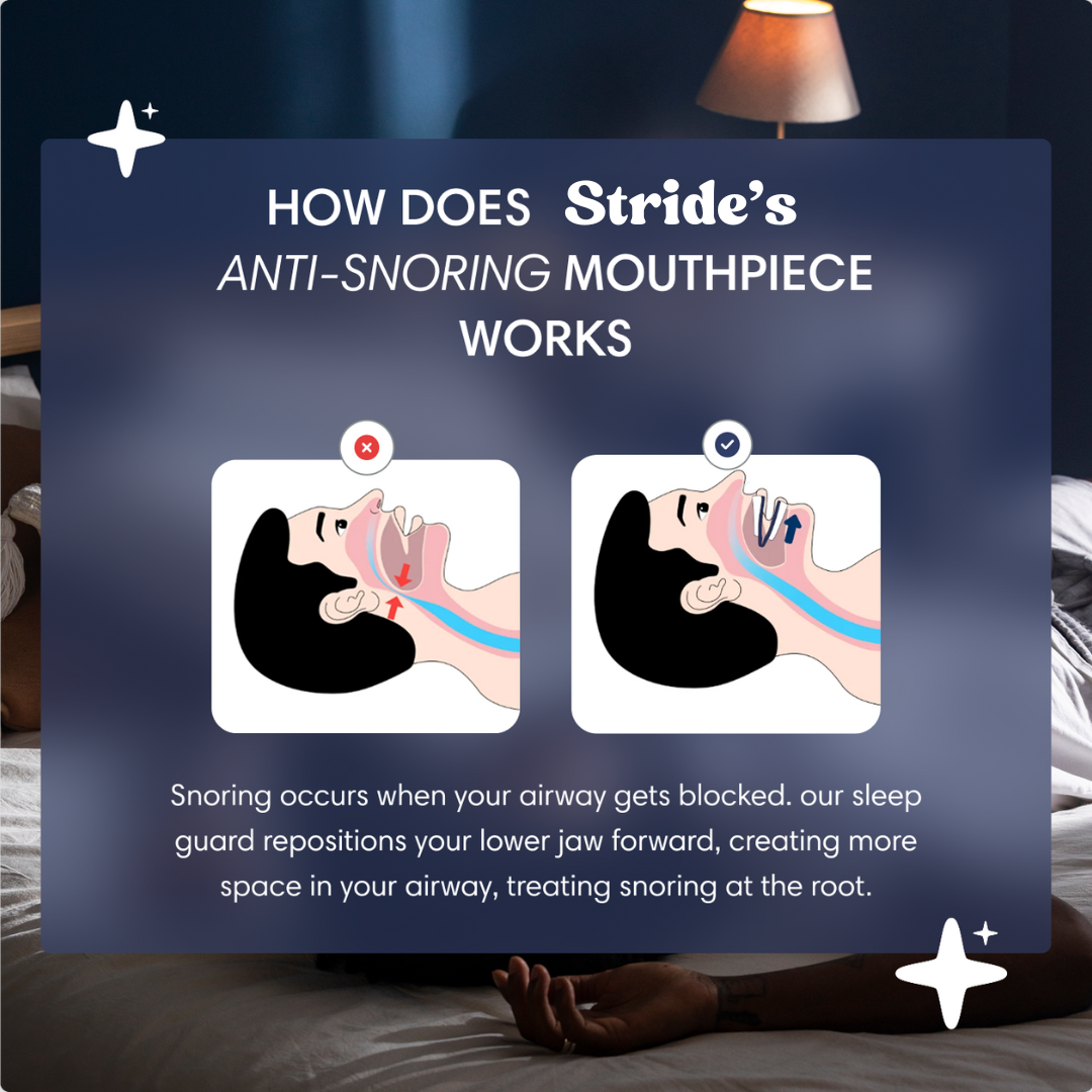 Anti Snore Mouth Guard