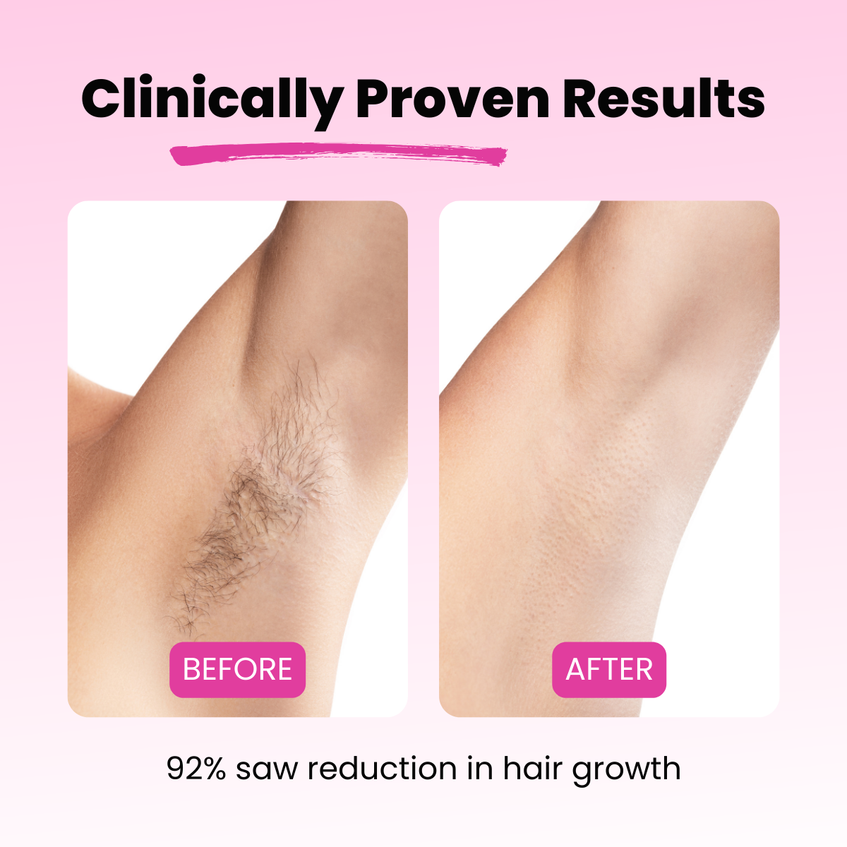 Cyperus Rotundus Oil Hair Removal