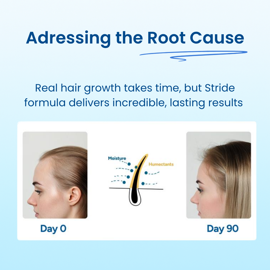 Advanced Hair Growth Roller Serum