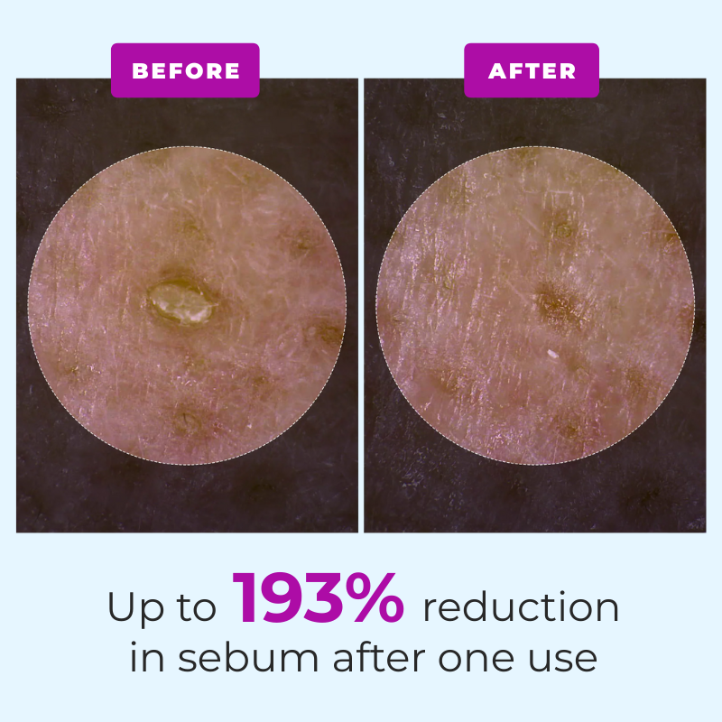 Peel Shot Serum