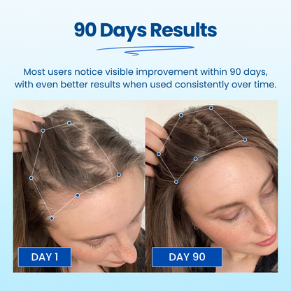 Advanced Hair Growth Roller Serum
