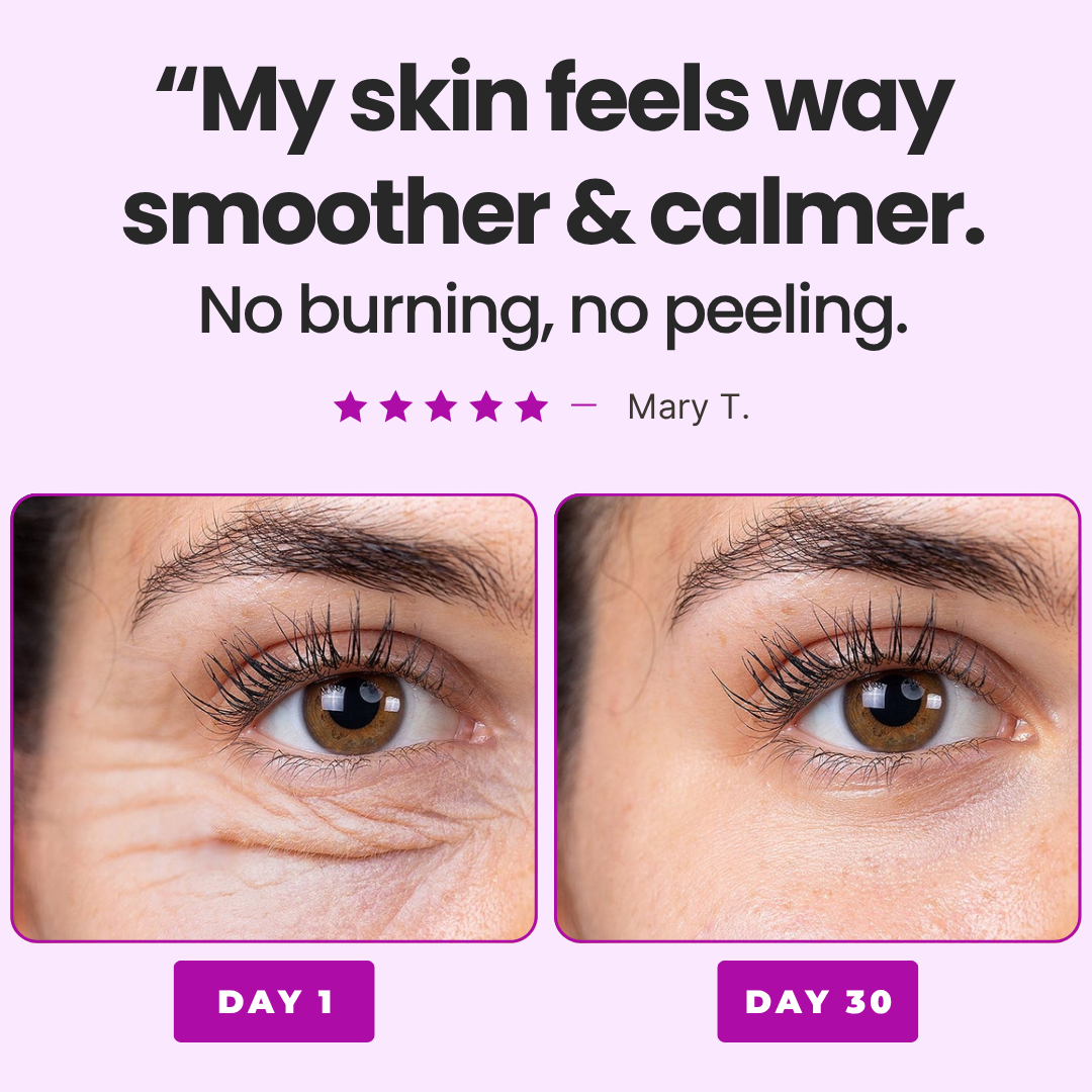 Anti Wrinkles Serum
