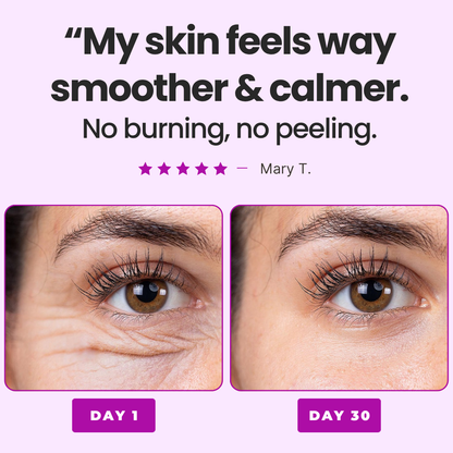 Anti Wrinkles Serum