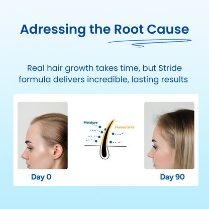 Advanced Hair Growth Roller Serum