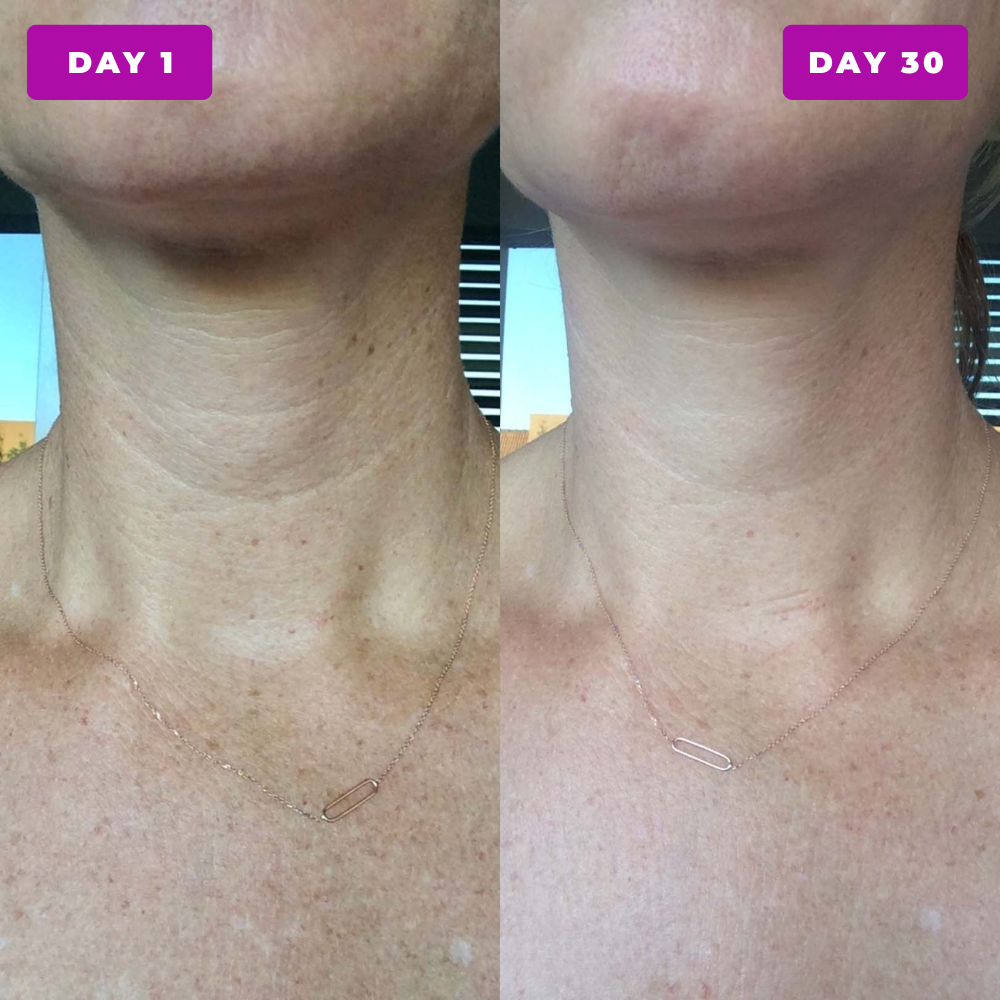 Stride Neck