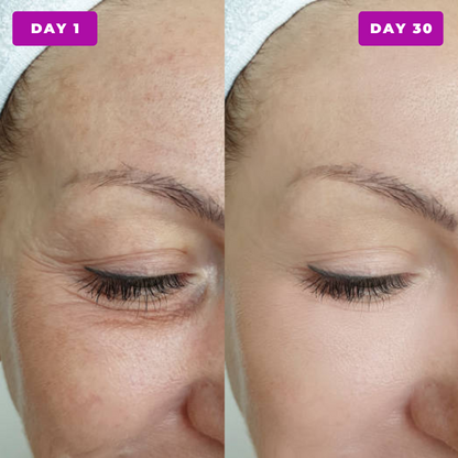 Anti Wrinkles Serum