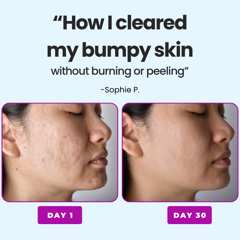Peel Shot Serum